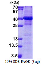 3ug by SDS-PAGE under reducing condition and visualized by coomassie blue stain.