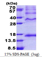 3ug by SDS-PAGE under reducing condition and visualized by coomassie blue stain.