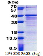 3ug by SDS-PAGE under reducing condition and visualized by coomassie blue stain.