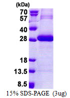 3ug by SDS-PAGE under reducing condition and visualized by coomassie blue stain.