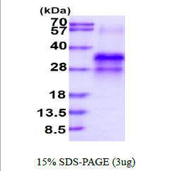 3ug by SDS-PAGE under reducing condition and visualized by coomassie blue stain.