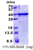 3ug by SDS-PAGE under reducing condition and visualized by coomassie blue stain.