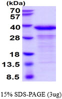 3ug by SDS-PAGE under reducing condition and visualized by coomassie blue stain.