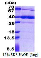 3ug by SDS-PAGE under reducing condition and visualized by coomassie blue stain.