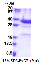 3ug by SDS-PAGE under reducing condition and visualized by coomassie blue stain.