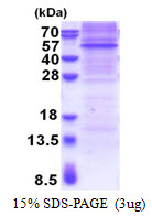 3ug by SDS-PAGE under reducing condition and visualized by coomassie blue stain.