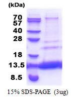 3ug by SDS-PAGE under reducing condition and visualized by coomassie blue stain.