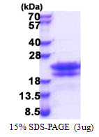 3ug by SDS-PAGE under reducing condition and visualized by coomassie blue stain.