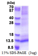 3ug by SDS-PAGE under reducing condition and visualized by coomassie blue stain.