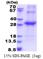 3ug by SDS-PAGE under reducing condition and visualized by coomassie blue stain.