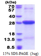 3ug by SDS-PAGE under reducing condition and visualized by coomassie blue stain.