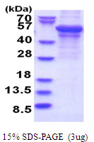 3ug by SDS-PAGE under reducing condition and visualized by coomassie blue stain.