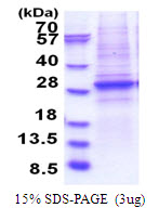 3ug by SDS-PAGE under reducing condition and visualized by coomassie blue stain.