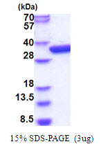 3ug by SDS-PAGE under reducing condition and visualized by coomassie blue stain.