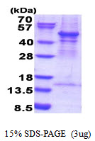 3ug by SDS-PAGE under reducing condition and visualized by coomassie blue stain.