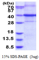 3ug by SDS-PAGE under reducing condition and visualized by coomassie blue stain.