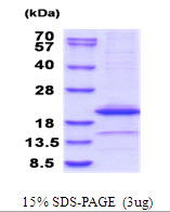 3ug by SDS-PAGE under reducing condition and visualized by coomassie blue stain.