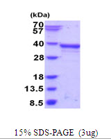 3ug by SDS-PAGE under reducing condition and visualized by coomassie blue stain.