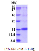 3ug by SDS-PAGE under reducing condition and visualized by coomassie blue stain.