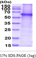 3ug by SDS-PAGE under reducing condition and visualized by coomassie blue stain.