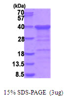 3ug by SDS-PAGE under reducing condition and visualized by coomassie blue stain.