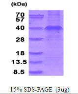 3ug by SDS-PAGE under reducing condition and visualized by coomassie blue stain.