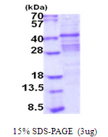 3ug by SDS-PAGE under reducing condition and visualized by coomassie blue stain.