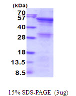 3ug by SDS-PAGE under reducing condition and visualized by coomassie blue stain.