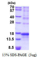 3ug by SDS-PAGE under reducing condition and visualized by coomassie blue stain.