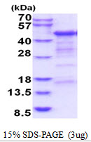 3ug by SDS-PAGE under reducing condition and visualized by coomassie blue stain.