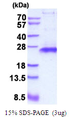 3ug by SDS-PAGE under reducing condition and visualized by coomassie blue stain.