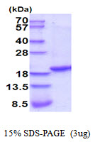 3ug by SDS-PAGE under reducing condition and visualized by coomassie blue stain.