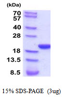 3ug by SDS-PAGE under reducing condition and visualized by coomassie blue stain.