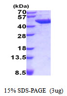 3ug by SDS-PAGE under reducing condition and visualized by coomassie blue stain.