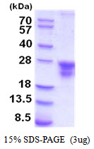 3ug by SDS-PAGE under reducing condition and visualized by coomassie blue stain.