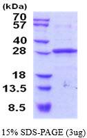 3ug by SDS-PAGE under reducing condition and visualized by coomassie blue stain.