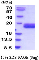 3ug by SDS-PAGE under reducing condition and visualized by coomassie blue stain.