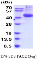 3ug by SDS-PAGE under reducing condition and visualized by coomassie blue stain.