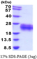 3ug by SDS-PAGE under reducing condition and visualized by coomassie blue stain.