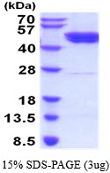 3ug by SDS-PAGE under reducing condition and visualized by coomassie blue stain.