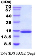 3ug by SDS-PAGE under reducing condition and visualized by coomassie blue stain.