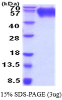 3ug by SDS-PAGE under reducing condition and visualized by coomassie blue stain.