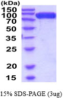 3ug by SDS-PAGE under reducing condition and visualized by coomassie blue stain.