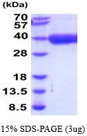 3ug by SDS-PAGE under reducing condition and visualized by coomassie blue stain.