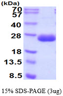 3ug by SDS-PAGE under reducing condition and visualized by coomassie blue stain.