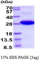 3ug by SDS-PAGE under reducing condition and visualized by coomassie blue stain.