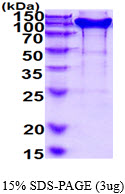 3ug by SDS-PAGE under reducing condition and visualized by coomassie blue stain.