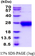 3ug by SDS-PAGE under reducing condition and visualized by coomassie blue stain.