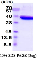 3ug by SDS-PAGE under reducing condition and visualized by coomassie blue stain.