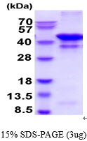 3ug by SDS-PAGE under reducing condition and visualized by coomassie blue stain.